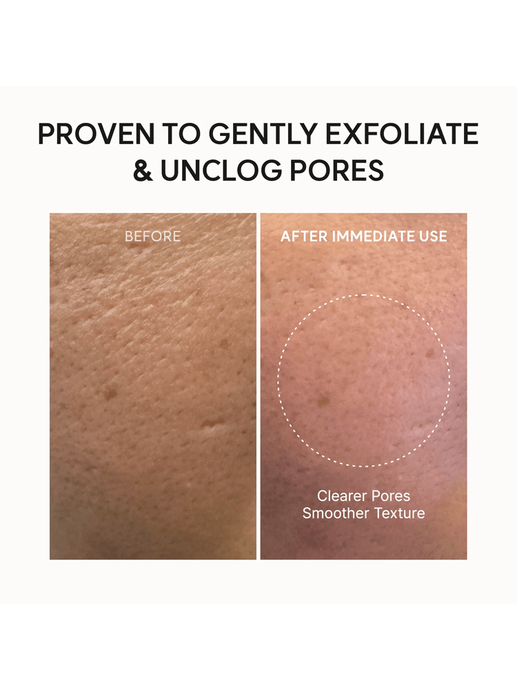ARENCIA Fresh Green Cleanser before and after showing clearer pores and smoother texture after immediate use.