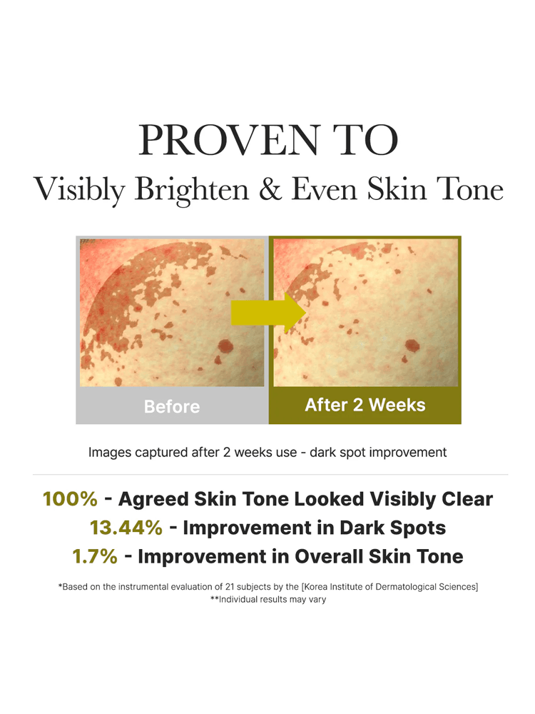 ARENCIA Vitamin Booster Shot before and after results showing improvement in skin tone and dark spots.