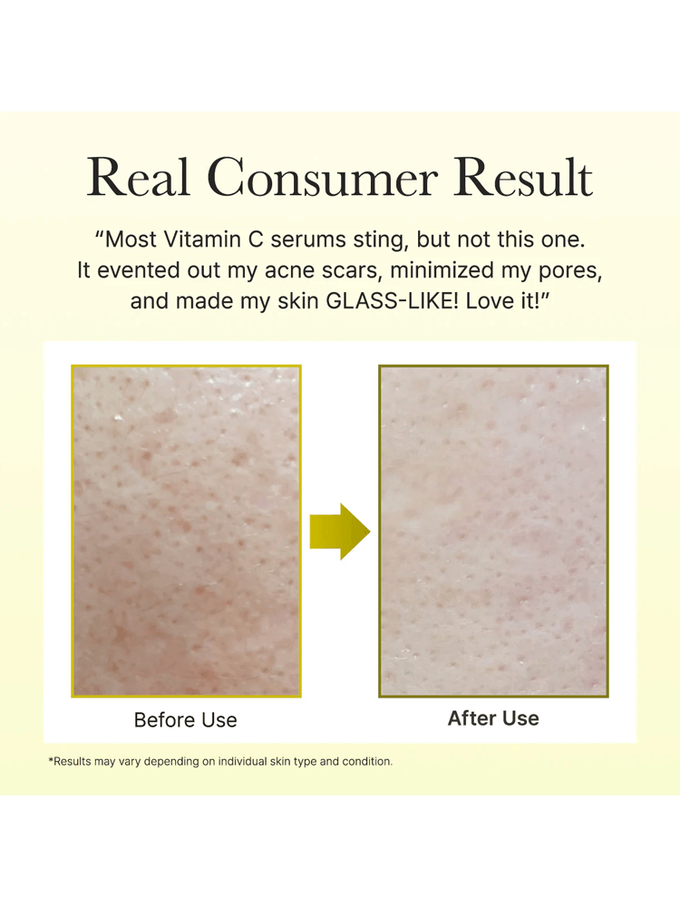 ARENCIA Vitamin Booster Shot before and after consumer results showcasing improved skin texture and radiance.