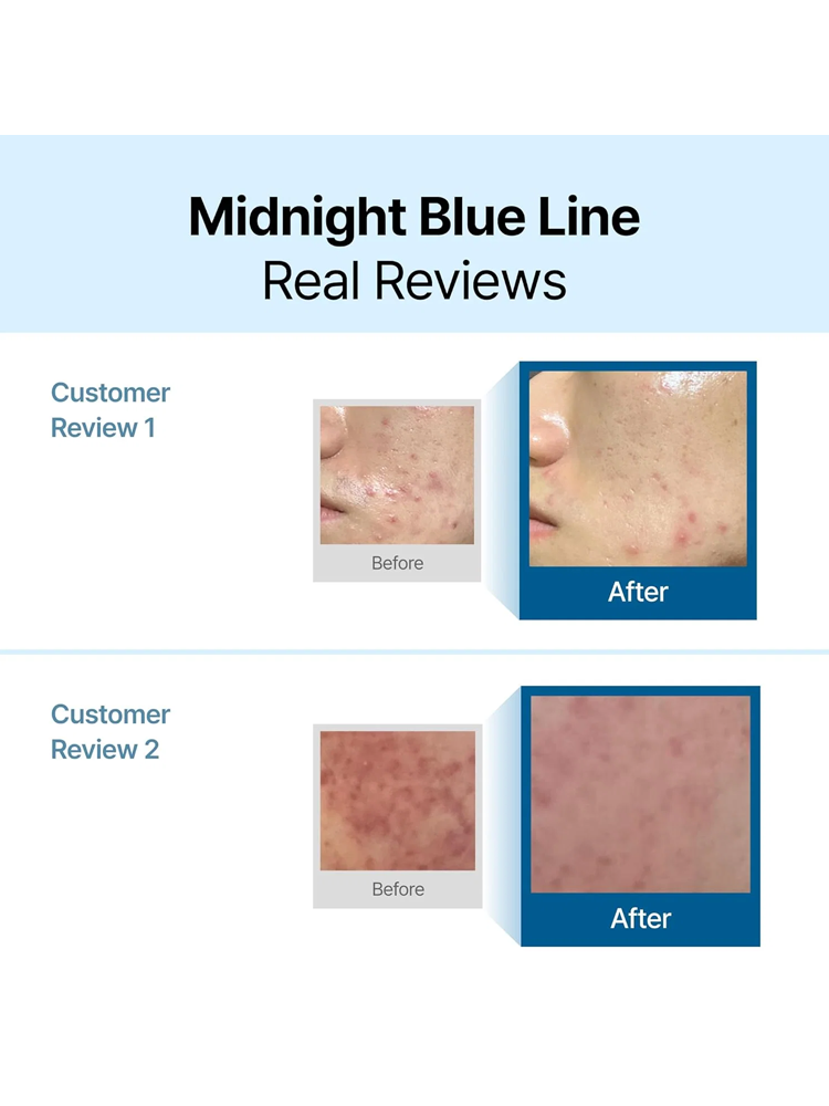 DEAR KLAIRS Midnignt Blue Calming Cream 60ml