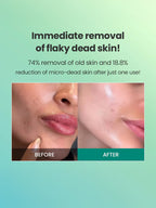 Dr G Brightening Peeling Gel 120g