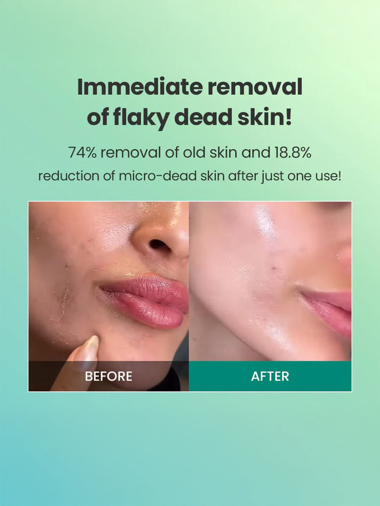 Dr G Brightening Peeling Gel 120g