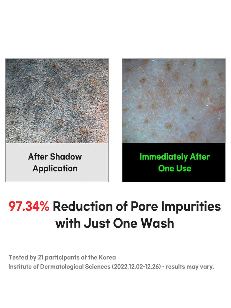 FATION Nosca9 Trouble Cleansing Foam 150ml