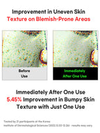 FATION Nosca9 Trouble Cleansing Foam 150ml