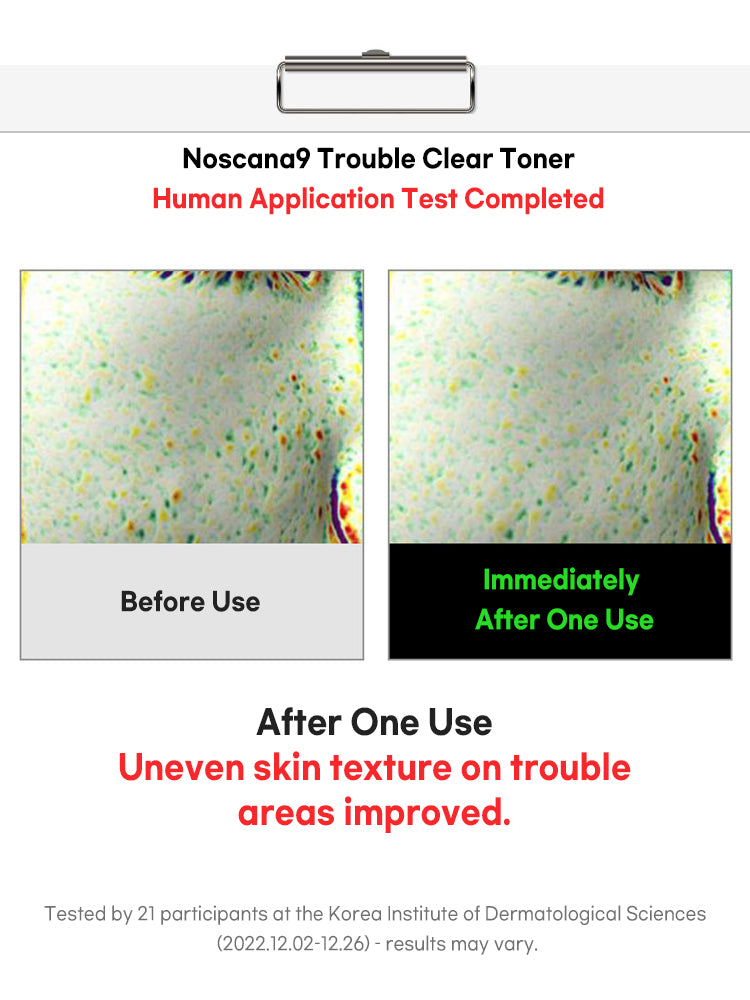 FATION Nosca9 Trouble Clear Toner 200ml