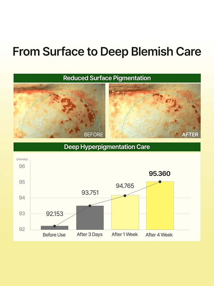 From Surface to Deep Blemish Care visuals showing reduced surface pigmentation before and after using GOODAL Green Tangerine Vita C Dark Spot Care Serum Mask Alpha.