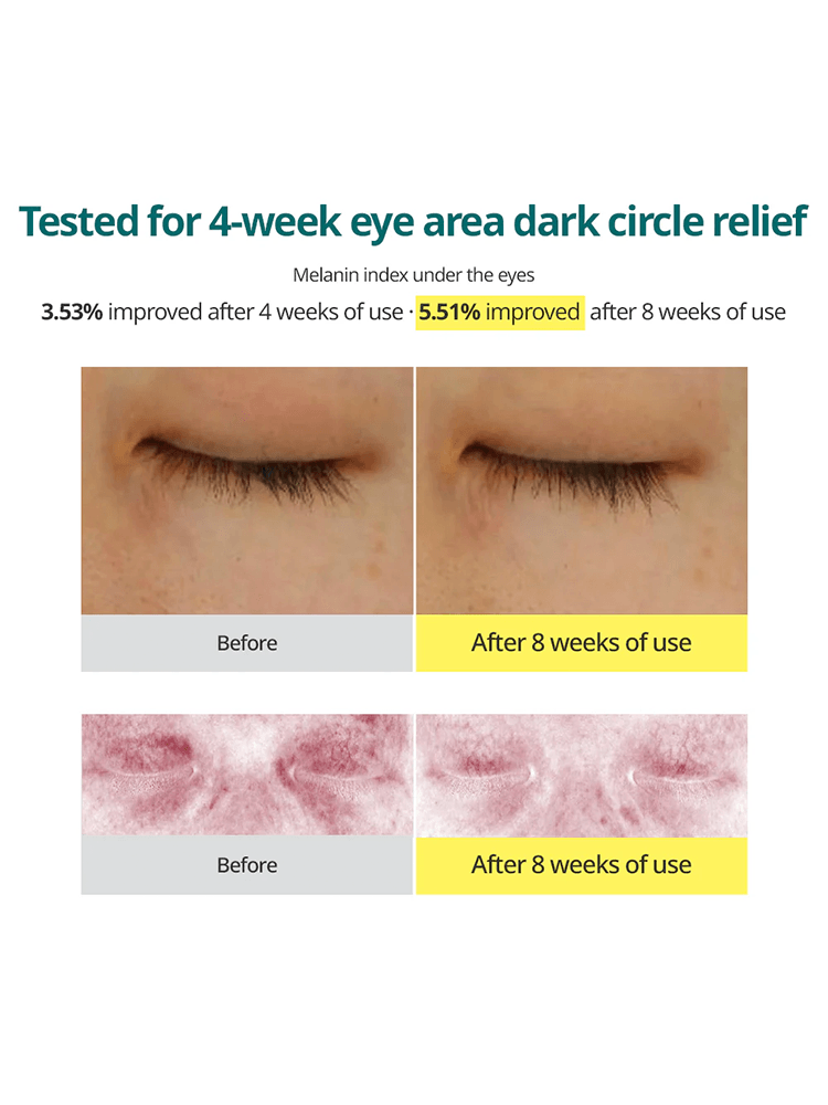 Before and after images showing improvement for GOODAL Green Tangerine Vita C Dark Spot Care Eye Cream, tested for dark circle relief.