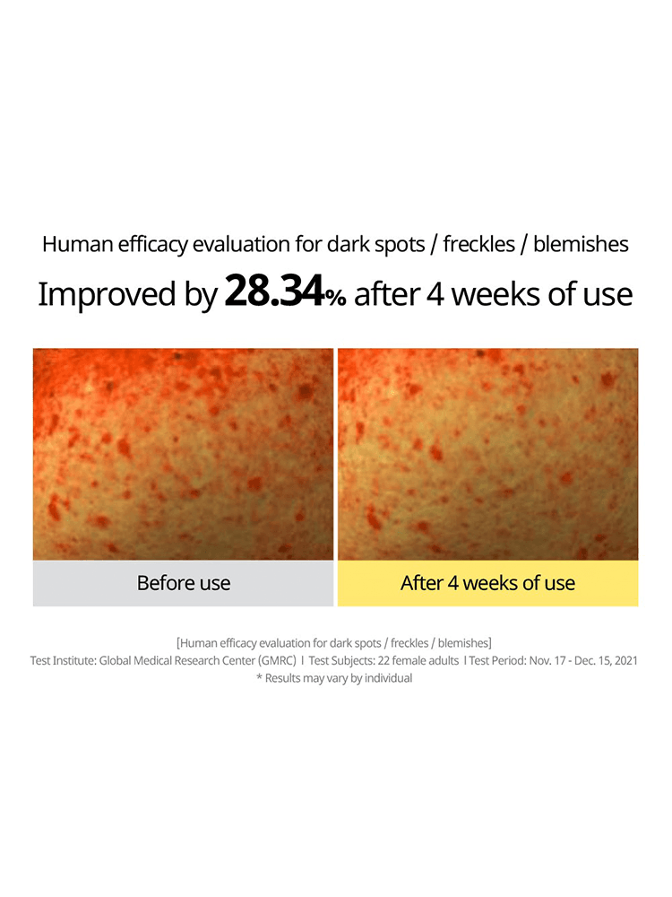 Before and after comparison of skin improvement by 28.34% after using GOODAL Green Tangerine Vita C Dark Spot Care Sun Serum.