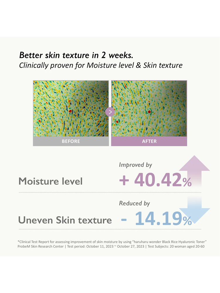 Before and after results showing improved moisture level and reduced uneven skin texture using HARUHARU WONDER Black Rice Hyaluronic Toner.