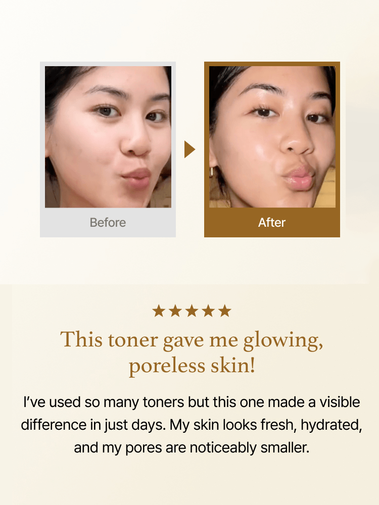 Before and after results of I'M FROM Rice Toner showcasing glowing, poreless skin.