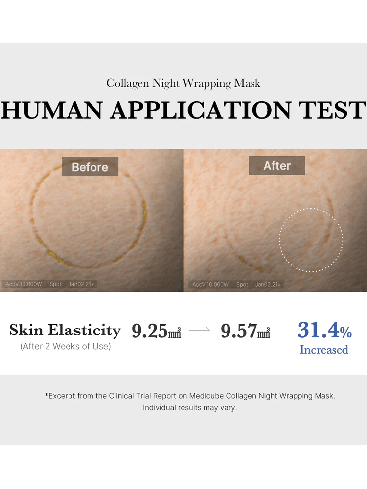 Before and after results of MEDICUBE Collagen Night Wrapping Mask showing increased skin elasticity after two weeks.