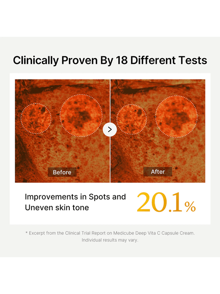 Clinically proven results showing improvements in spots and uneven skin tone using MEDICUBE Deep Vita C Capsule Cream