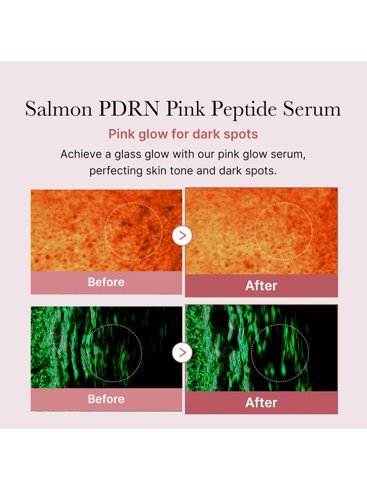Before and after images showcasing effects of MEDICUBE PDRN Pink Peptide Serum on skin tone and dark spots.