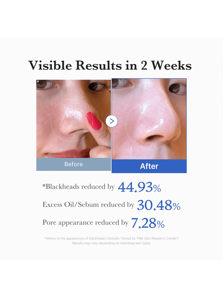 Visible results of MEDICUBE Zero Pore Pad 2.0 155g showing improvement in blackheads, oil, and pore appearance.