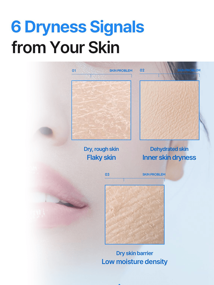 MEDIHEAL Hyaluronate Essential Mask Ultra Hydration Image showing 6 dryness signals from your skin: flaky skin, inner skin dryness, and low moisture density.