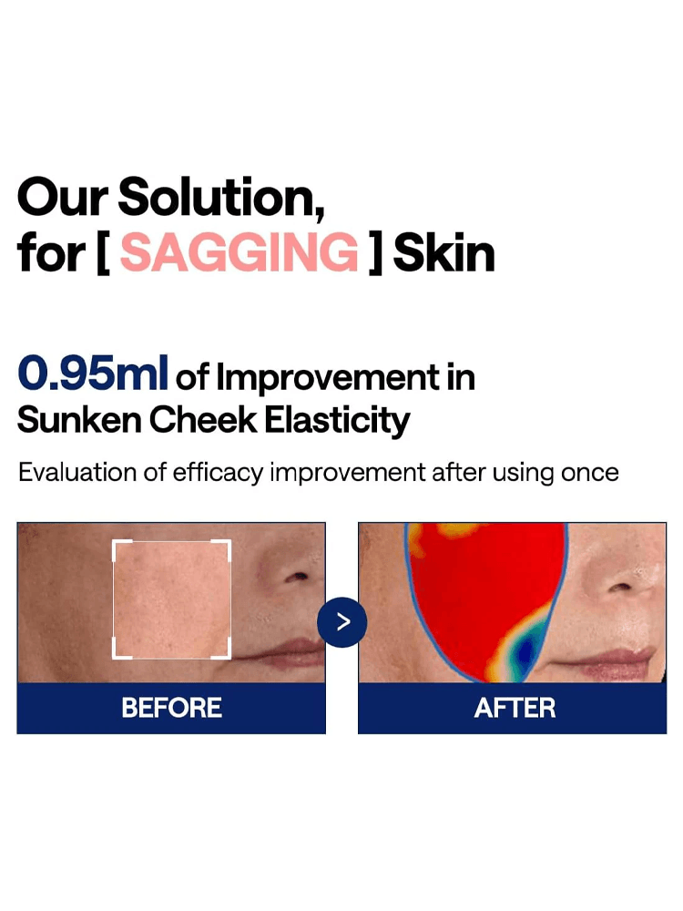 MEDIHEAL Collagen Ampoule Pad Before and after comparison showing 0.95ml improvement in sunken cheek elasticity for sagging skin.