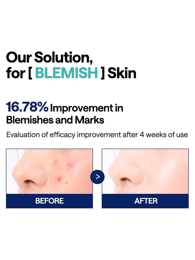 MEDIHEAL Madecassoside Blemish Pad before and after results showing 16.78% improvement in blemishes and marks.