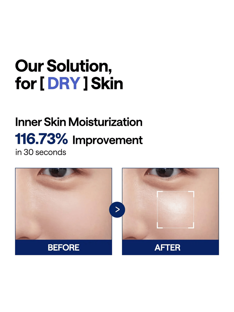 Comparison of inner skin moisture improvement before and after using MEDIHEAL Watermide Moisture Pad.