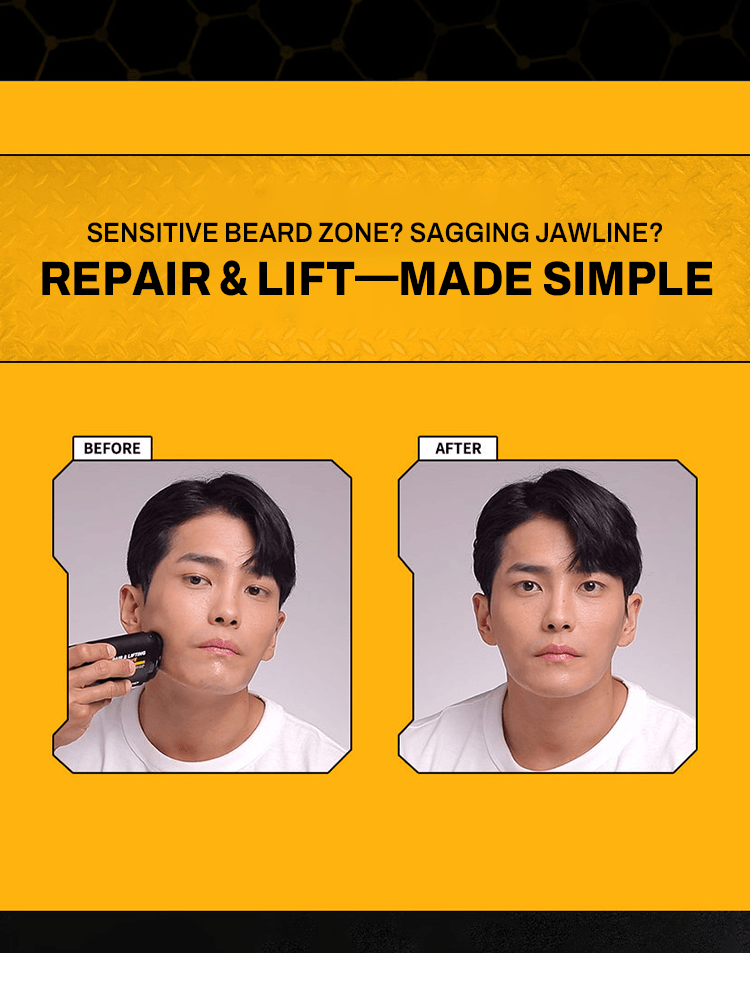 MIP Repair & Lifting After Shave before and after images showing improvement in beard zone care and jawline firmness.