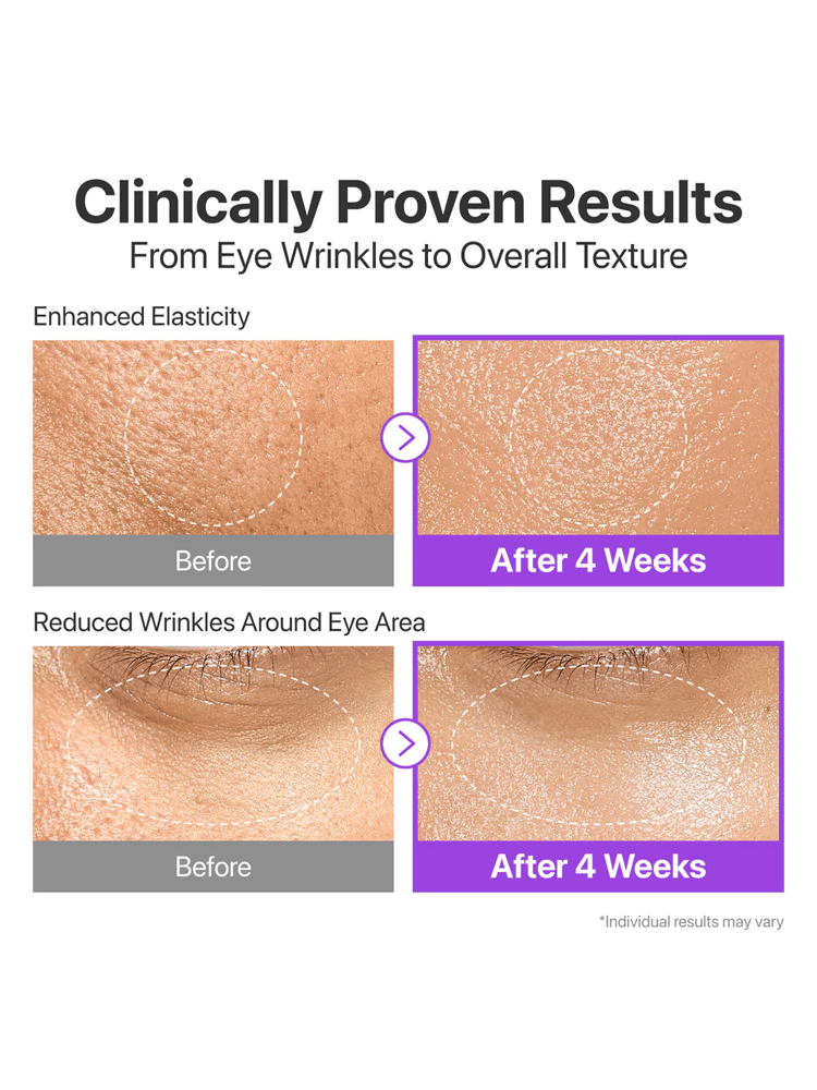 Clinically Proven Results for NUMBUZIN NAD Bio Lifting-sil Essence: Enhanced Elasticity and Reduced Wrinkles.