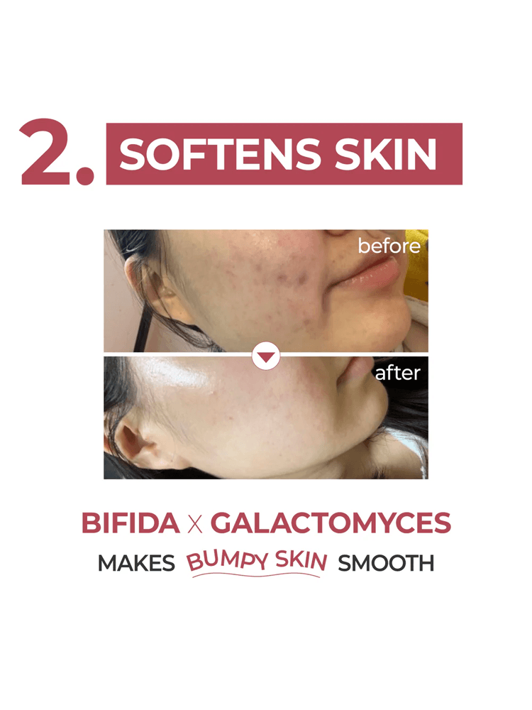 Before and after images showcasing the effect of NUMBUZIN No.3 Skin Softening Serum on bumpy skin texture.