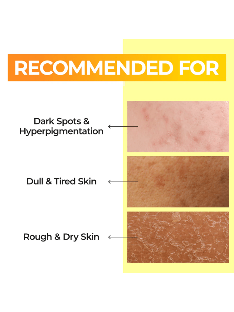 NUMBUZIN.No.5 Vitamin Boosting Essence Toner Recommended for dark spots, dull skin, and rough skin; showcasing skincare solutions.