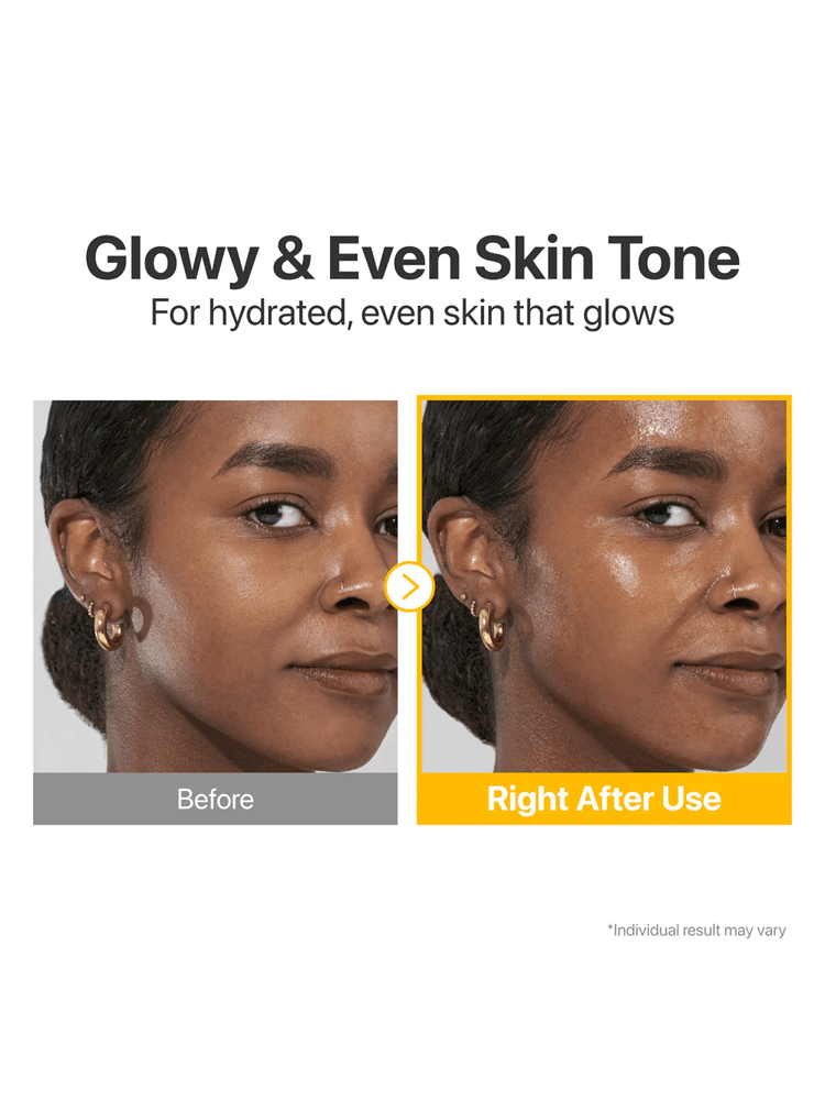Before and after results of using NUMBUZIN No.5 Vitamin Concentrated Serum for glowing skin.