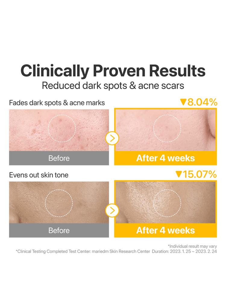 Clinically proven results showing dark spot fading and improved skin tone with NUMBUZIN No.5 Vitamin-Niacinamide Concentrated Pad.