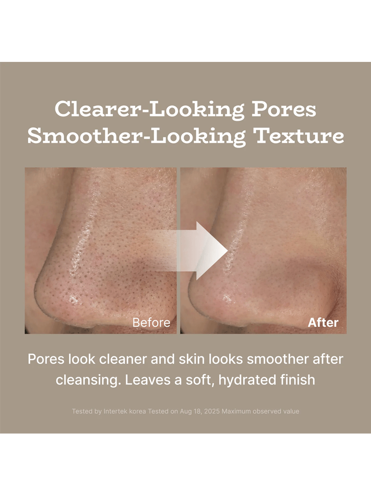 Before and after comparison showing clearer pores and smoother texture after using PODL 2X Fresh Bam Balm To Foam.