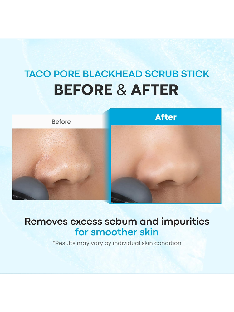 TONYMOLY Tako Pore Blackhead Scrub Stick 10g