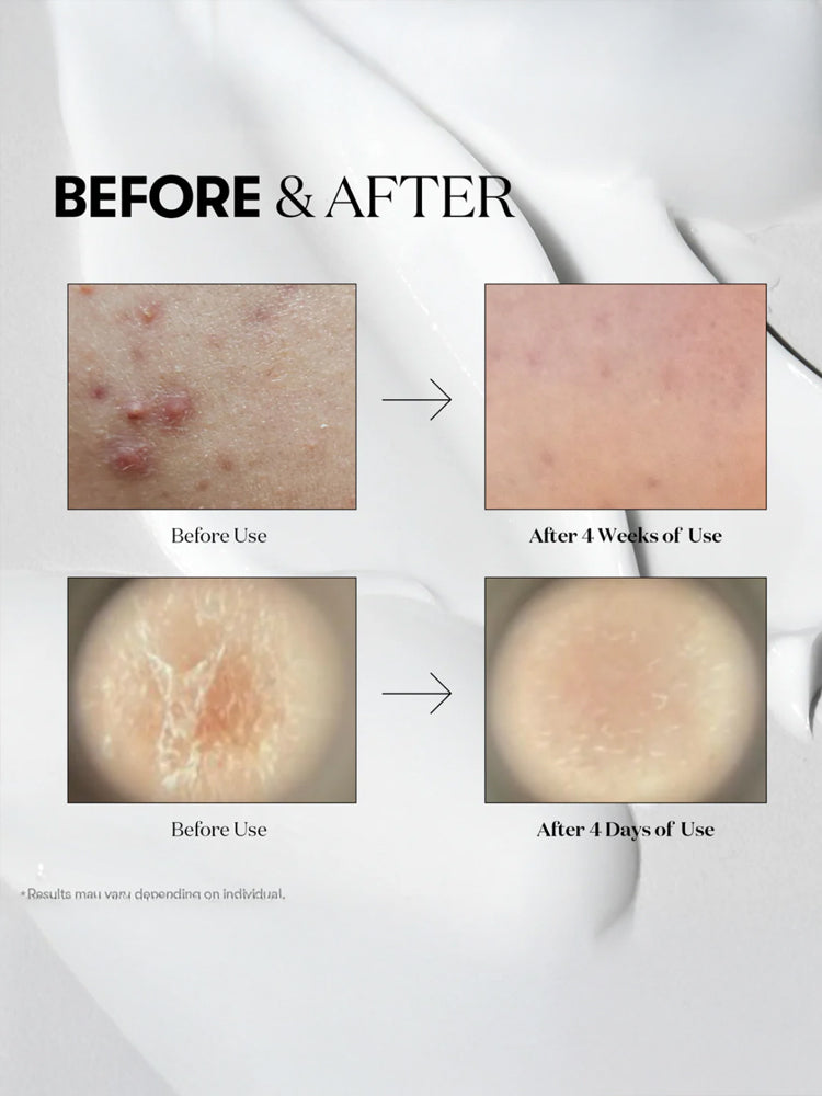 VT Reedle Shot 100 50ml