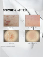 VT Reedle Shot 300 50ml